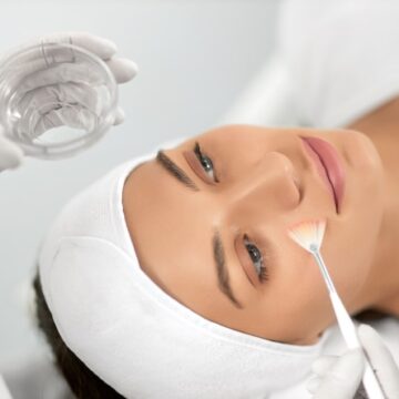 Chemical Peels