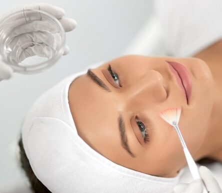 Chemical Peels