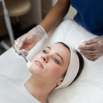 The Science Behind Chemical Peels: A Comprehensive Guide