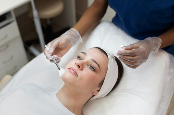 The Science Behind Chemical Peels: A Comprehensive Guide
