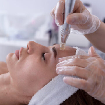 Skin Needling